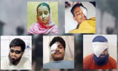 11 Left Blind, 493 Lost One Eye in Bangladesh Protests: Doctor Testifies