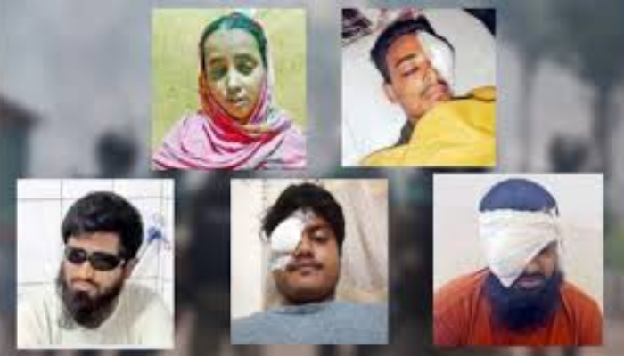 11 Left Blind, 493 Lost One Eye in Bangladesh Protests: Doctor Testifies 11 Left Blind, 493 Lost One Eye in Bangladesh Protests: Doctor Testifies