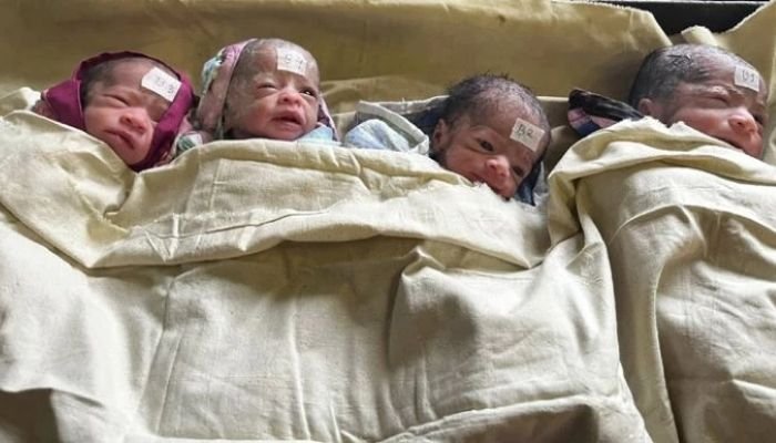 Quadruplets Born at Chittagong Medical College Hospital Quadruplets Born at Chittagong Medical College Hospital