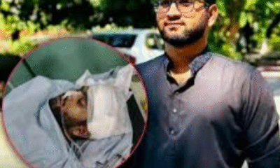 CU Student Sayem Still Unconscious Five Days After Clash