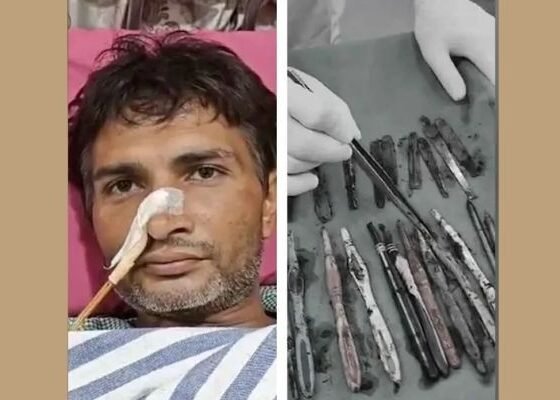 Ghaziabad man’s stomach filled with 29 spoons, 19 toothbrushes