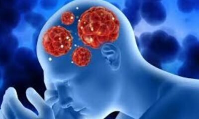 Kerala: 19 Dead in 2025 From Rare ‘Brain-Eating Amoeba’ Infection