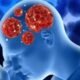 Kerala: 19 Dead in 2025 From Rare ‘Brain-Eating Amoeba’ Infection