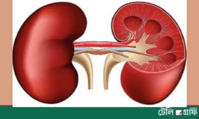 Kidney Disease Cases Double Worldwide Since 1990: The Lancet