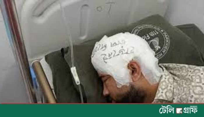 CU Clash Victim Mamun Undergoes Successful Skull Surgery