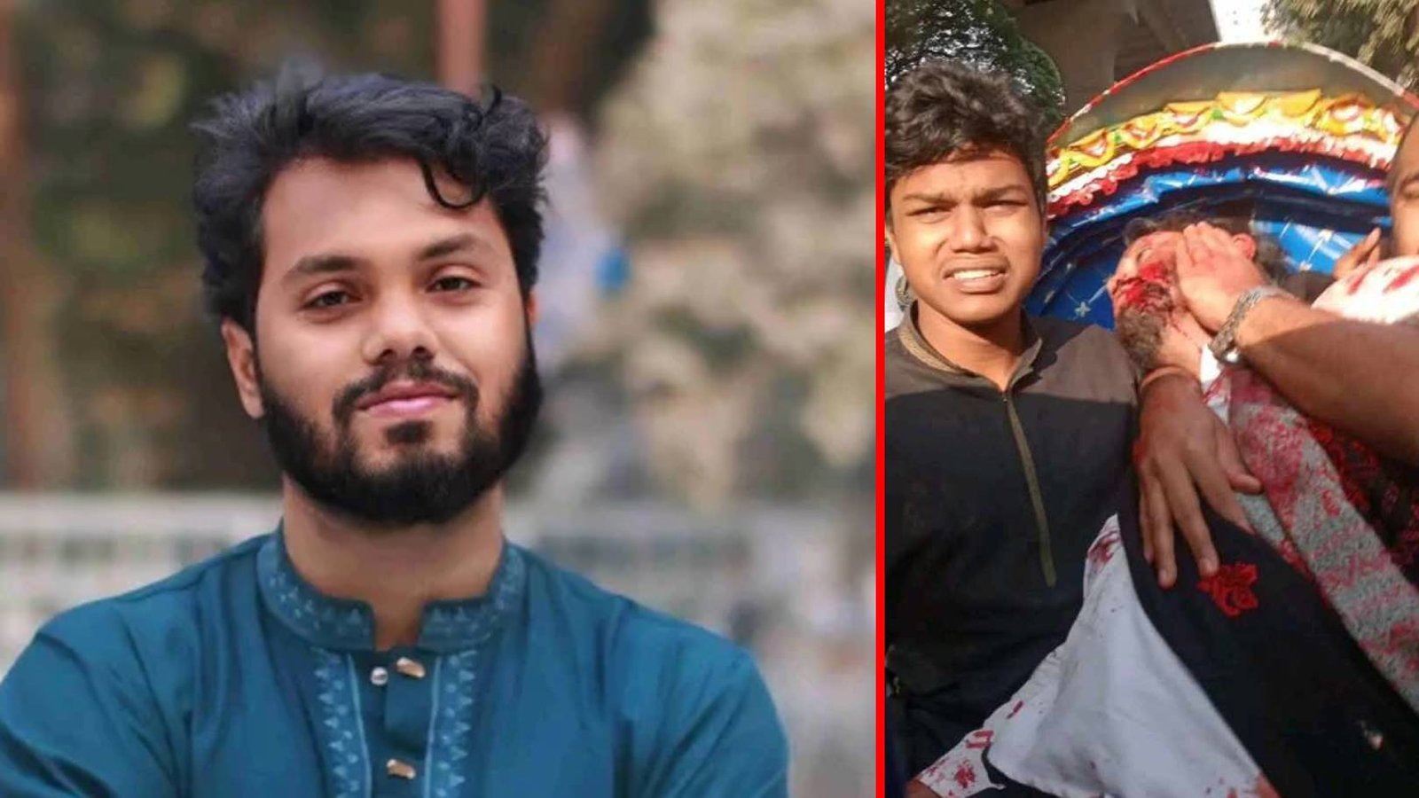 Shot Candidate Hadi Undergoes Surgery, Being Moved to Evercare Hospital